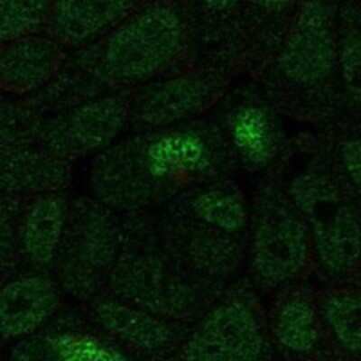 Immunocytochemistry/ Immunofluorescence: HOXA13 Antibody [NBP3-17383]