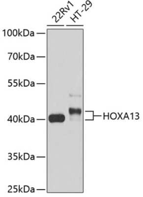 Western Blot: HOXA13 AntibodyBSA Free [NBP3-04716]