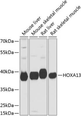 Western Blot: HOXA13 AntibodyBSA Free [NBP3-04717]