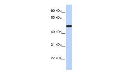 Western Blot: HOXA3 Antibody [NBP2-85060]