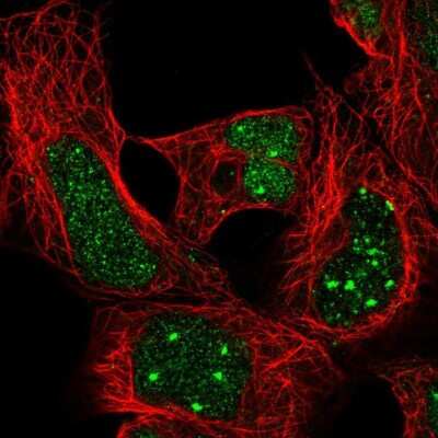 Immunocytochemistry/ Immunofluorescence: HOXA4 Antibody [NBP2-32515]