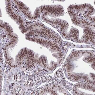 Immunohistochemistry-Paraffin: HOXA4 Antibody [NBP2-32515]