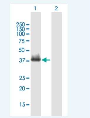 Western Blot: HOXA4 Antibody [H00003201-B01P-50ug]