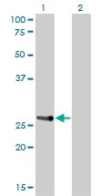 Western Blot: HOXA7 Antibody (2F2) [H00003204-M01]