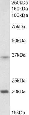 Western Blot: HOXA9 Antibody [NBP1-52166]