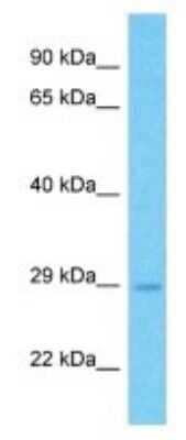 Western Blot: HOXA9 Antibody [NBP3-09930]