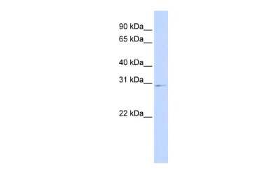 Western Blot: HOXA9 Antibody [NBP3-10527]
