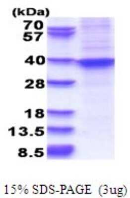 SDS-PAGE: Recombinant Human HOXA9 His Protein [NBP2-51680]