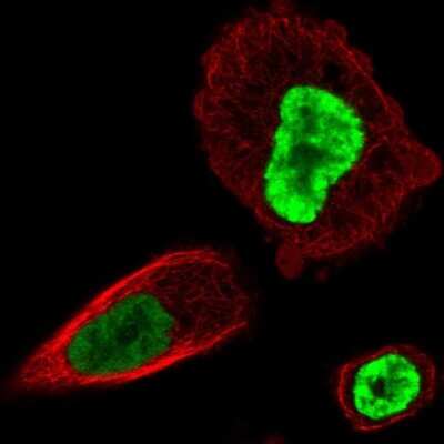 Immunocytochemistry/ Immunofluorescence: HOXB13 Antibody [NBP2-48778]