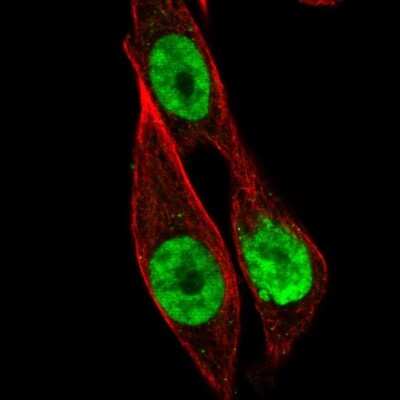 Immunocytochemistry/ Immunofluorescence: HOXB13 Antibody [NBP2-49375]
