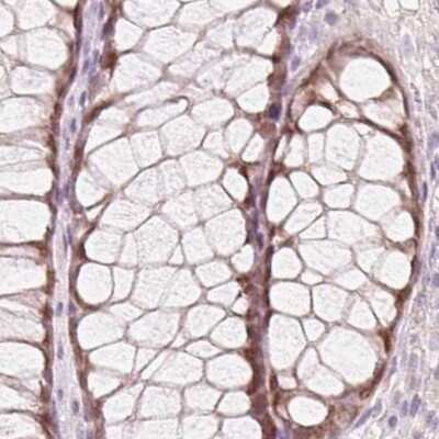 Immunohistochemistry-Paraffin: HOXB13 Antibody [NBP2-49375]