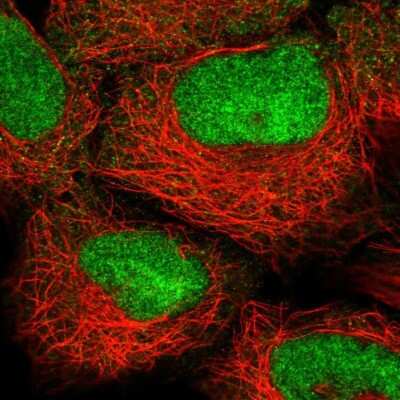 Immunocytochemistry/ Immunofluorescence: HOXB2 Antibody [NBP2-56905]