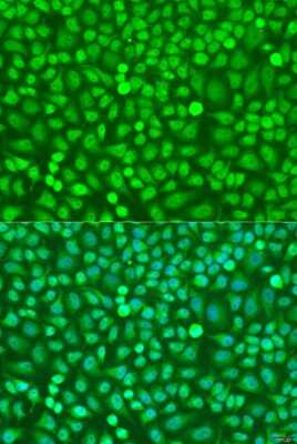 Immunocytochemistry/ Immunofluorescence: HOXB5 Antibody - Azide and BSA Free [NBP3-04470]