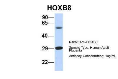 Western Blot: HOXB8 Antibody [NBP2-83058]