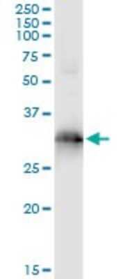 Immunoprecipitation: HOXB9 Antibody (4C3) [H00003219-M03]