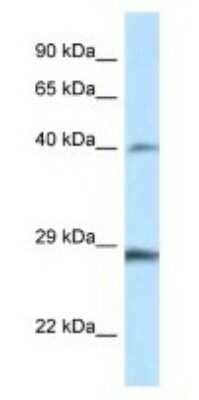 Western Blot: HOXB9 Antibody [NBP1-82370]