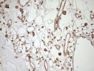 Immunohistochemistry: HOXC10 Antibody (OTI5C10) [NBP2-46000]