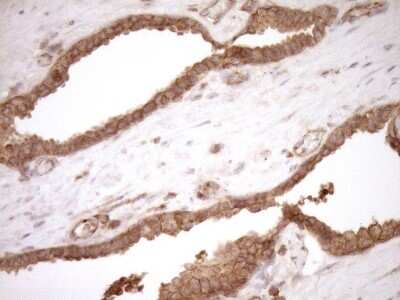 Immunohistochemistry: HOXC10 Antibody (OTI5C10) [NBP2-46000]