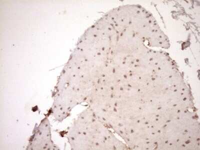 Immunohistochemistry: HOXC10 Antibody (OTI5C10) [NBP2-46000]