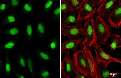 Immunocytochemistry/ Immunofluorescence: HOXC10 Antibody [NBP2-16874]
