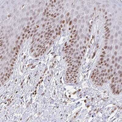 Immunohistochemistry: HOXC10 Antibody [NBP2-33699]