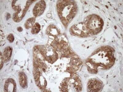 Immunohistochemistry: HOXC10 Antibody (OTI5C10) - Azide and BSA Free [NBP2-70909]