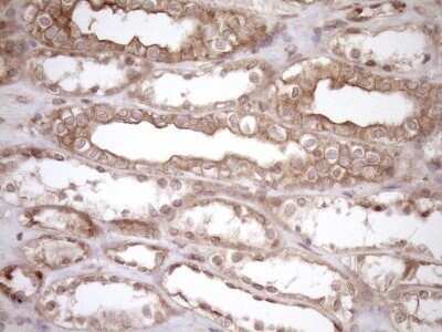 Immunohistochemistry: HOXC10 Antibody (OTI5C10) - Azide and BSA Free [NBP2-70909]