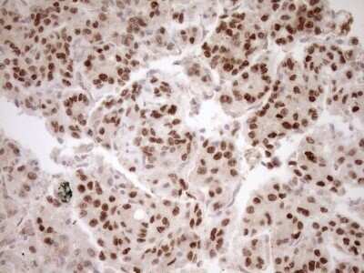 Immunohistochemistry: HOXC10 Antibody (OTI5C10) - Azide and BSA Free [NBP2-70909]