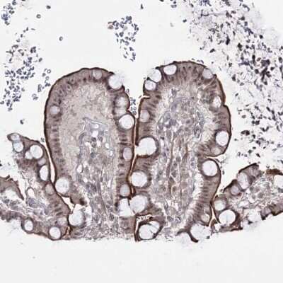 Immunohistochemistry-Paraffin: HOXC11 Antibody [NBP1-83230]