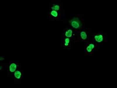 Immunocytochemistry/ Immunofluorescence: HOXC11 Antibody (OTI3E10) - Azide and BSA Free [NBP2-70913]