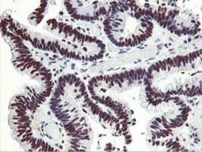 Immunohistochemistry: HOXC11 Antibody (OTI3E10) - Azide and BSA Free [NBP2-70913]