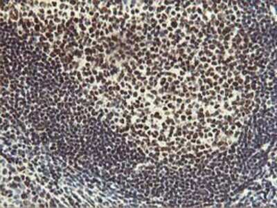 Immunohistochemistry: HOXC11 Antibody (OTI3E10) - Azide and BSA Free [NBP2-70913]