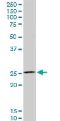 Western Blot: HOXC12 Antibody (1C6) [H00003228-M01]