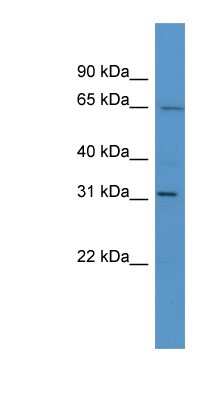 Western Blot: HOXC12 Antibody [NBP1-68929]