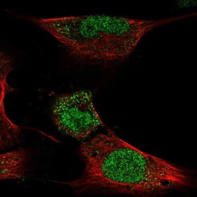 Immunocytochemistry/ Immunofluorescence: HOXC4 Antibody [NBP2-56195]