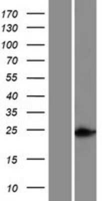 Western Blot: HOXC5 Overexpression Lysate [NBP2-06753]