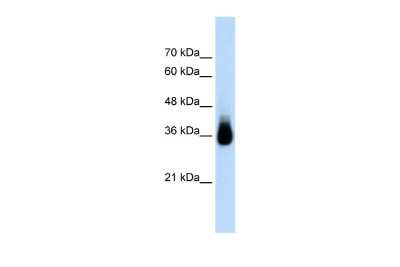 Western Blot: HOXC9 Antibody [NBP2-87598]