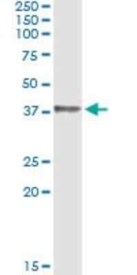 Immunoprecipitation: HOXD1 Antibody (4F4) [H00003231-M01]