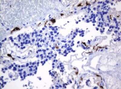 Immunohistochemistry: HOXD10 Antibody (OTI1D11) [NBP2-45744]