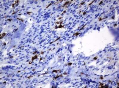 Immunohistochemistry: HOXD10 Antibody (OTI1D11) [NBP2-45744]