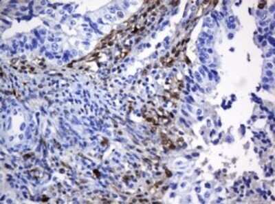 Immunohistochemistry: HOXD10 Antibody (OTI1D11) - Azide and BSA Free [NBP2-70920]