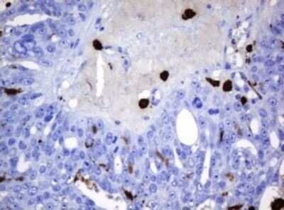 Immunohistochemistry: HOXD10 Antibody (OTI1D11) - Azide and BSA Free [NBP2-70920]