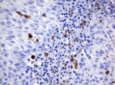 Immunohistochemistry: HOXD10 Antibody (OTI1D11) - Azide and BSA Free [NBP2-70920]