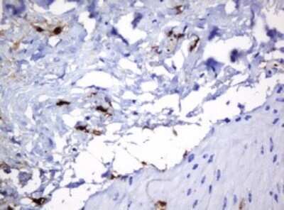 Immunohistochemistry: HOXD10 Antibody (OTI1D11) - Azide and BSA Free [NBP2-70920]