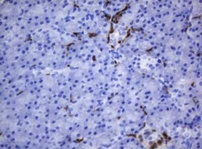 Immunohistochemistry: HOXD10 Antibody (OTI1D11) - Azide and BSA Free [NBP2-70920]