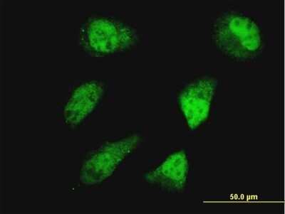 Immunocytochemistry/ Immunofluorescence: HOXD11 Antibody (5G4) [H00003237-M03]