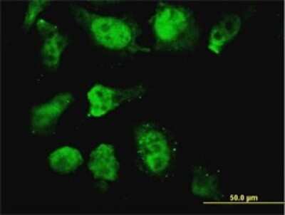 Immunocytochemistry/ Immunofluorescence: HOXD11 Antibody (6C8) [H00003237-M10]