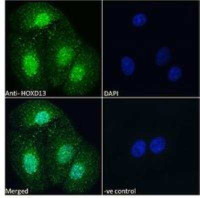 Immunocytochemistry/ Immunofluorescence: HOXD13 Antibody [NBP2-75091]