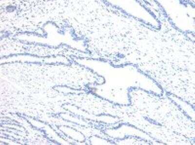 Immunohistochemistry-Paraffin: HOXD13 Antibody [NBP2-75091]