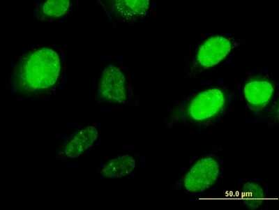 Immunocytochemistry/ Immunofluorescence: HOXD3 Antibody (1B12) [H00003232-M09]